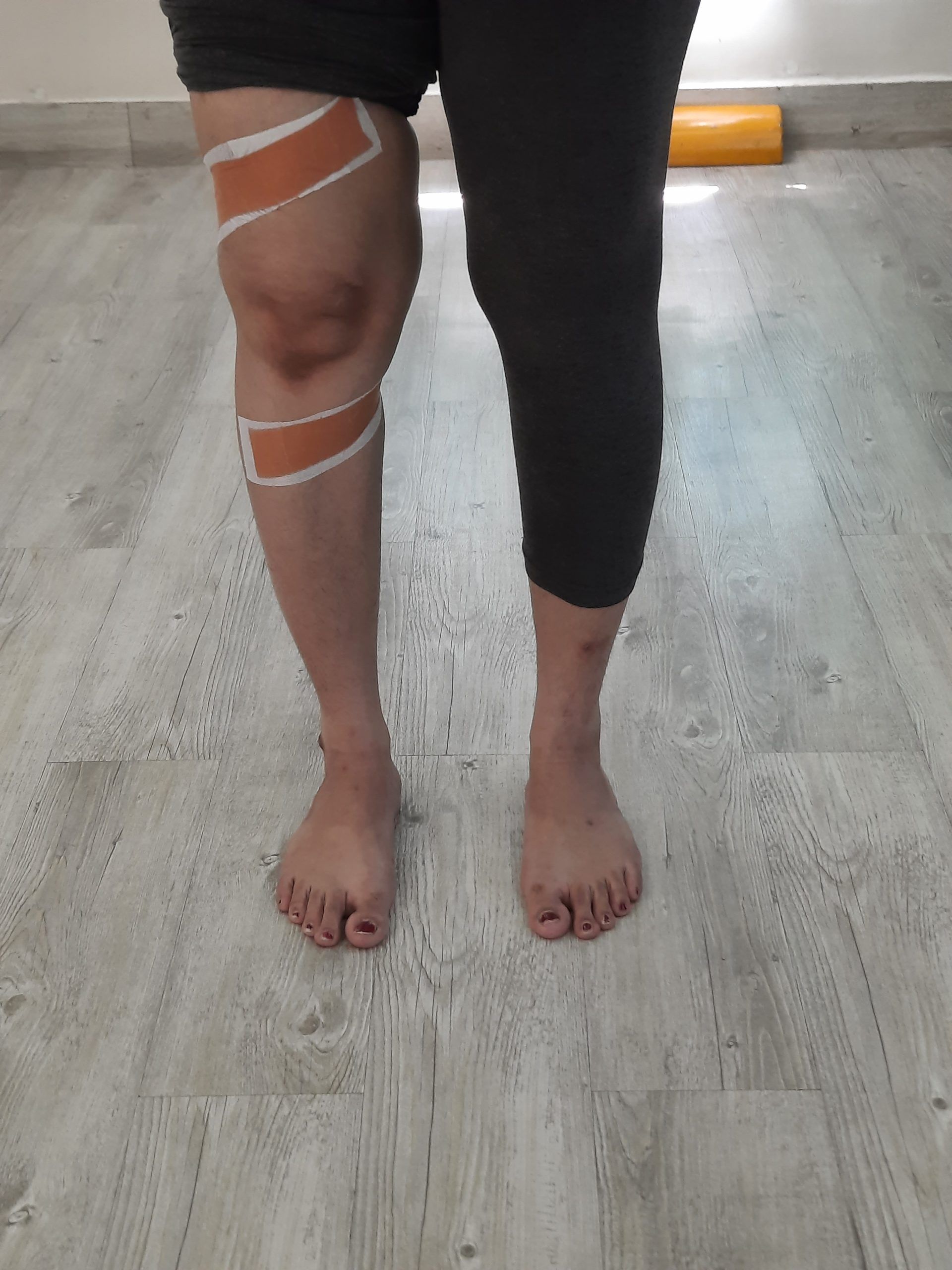 taping techniques